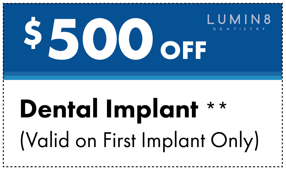 500 off dental implants