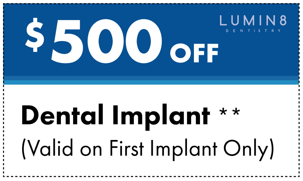 $500 Off Dental Implants